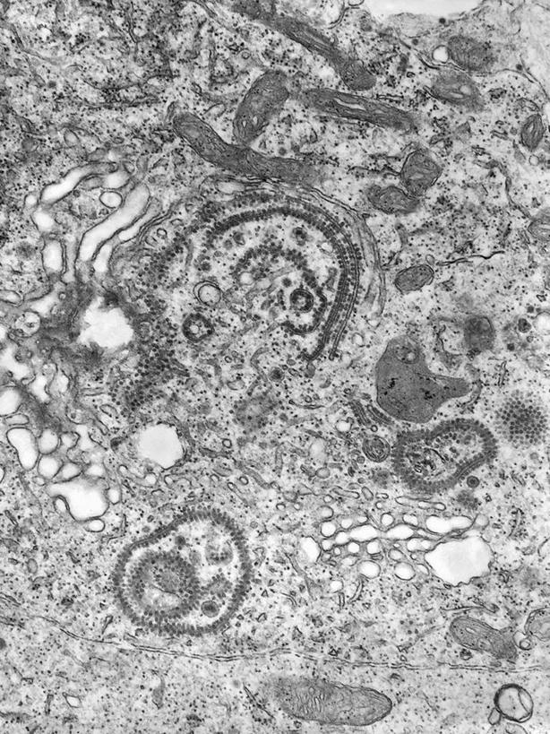 无人,竖图,黑白,科学,生病,摄影,病毒,脑炎,电子显微镜,披膜病毒