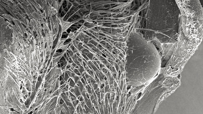 无人,横图,黑白,抽象,野生动物,科学,蚂蚁,蜘蛛网,动物,摄影,复眼,电子显微镜