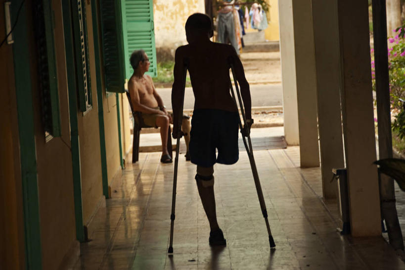 成年人,中年人,两个人,病人,护士,横图,越南,生病,治疗,摄影,拐杖,手术,医疗,开刀,病患,剪影,残疾,胡志明市,麻风病,男人,中年男性,患者,就医者,彩图,外科手术