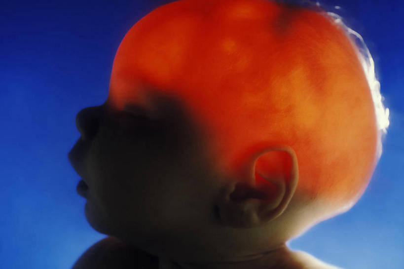 西方人,婴儿,头,一个人,横图,特写,侧面,失败,欧洲,欧洲人,发光,科学,人头骨,光亮,生病,摄影,忧虑,肖像,逆光,白种人,头部,彩图,状态