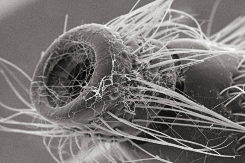 无人,横图,黑白,仪器,检查,反射,分析,科学,昆虫,显微镜,观察,清晰,探索,摄影,放大,观看,仔细,死亡,透镜,凸透镜,聚焦,关注,甲虫,骨折,受伤,节肢动物,光学,清楚,损伤,挫伤,扫描电镜,扫描电子显微镜