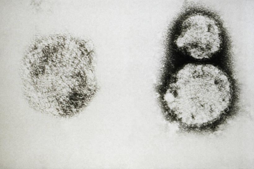 无人,横图,黑白,生病,摄影,病毒,透射电子显微镜