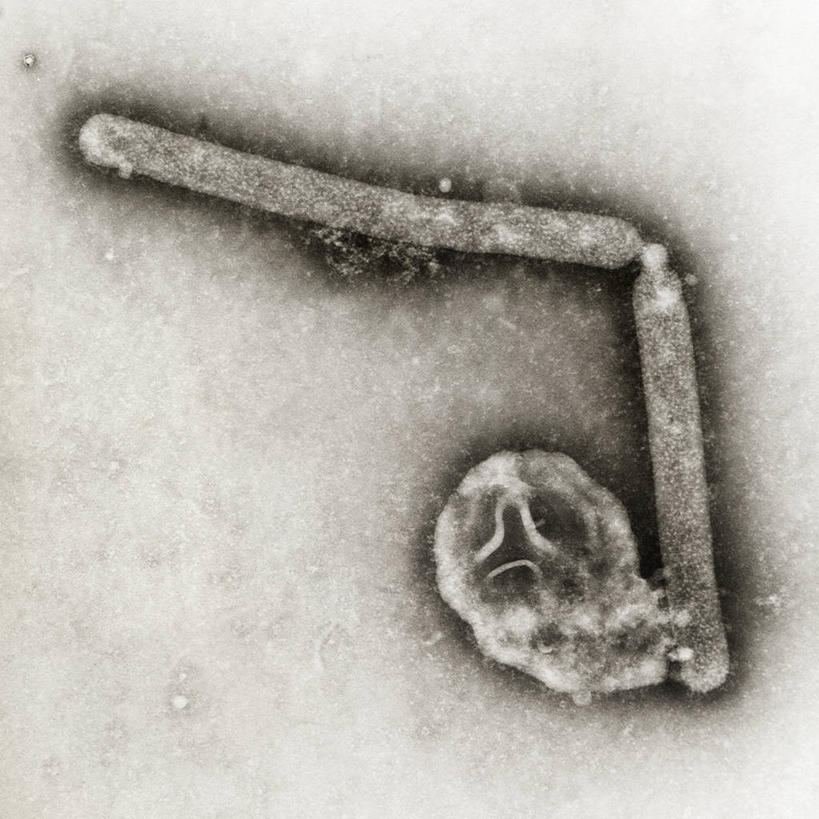 无人,方图,黑白,摄影,感冒,病毒,禽流感病毒,流感病毒,透射电子显微镜