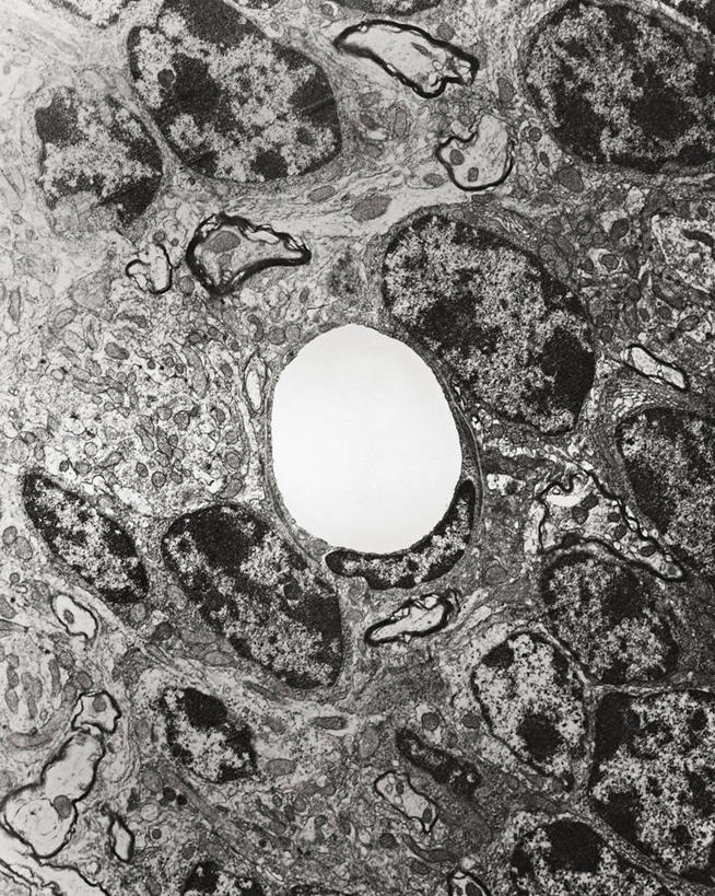 脑,毛细血管,无人,竖图,黑白,生病,摄影,鼠,横截面,透射电子显微镜,基底膜