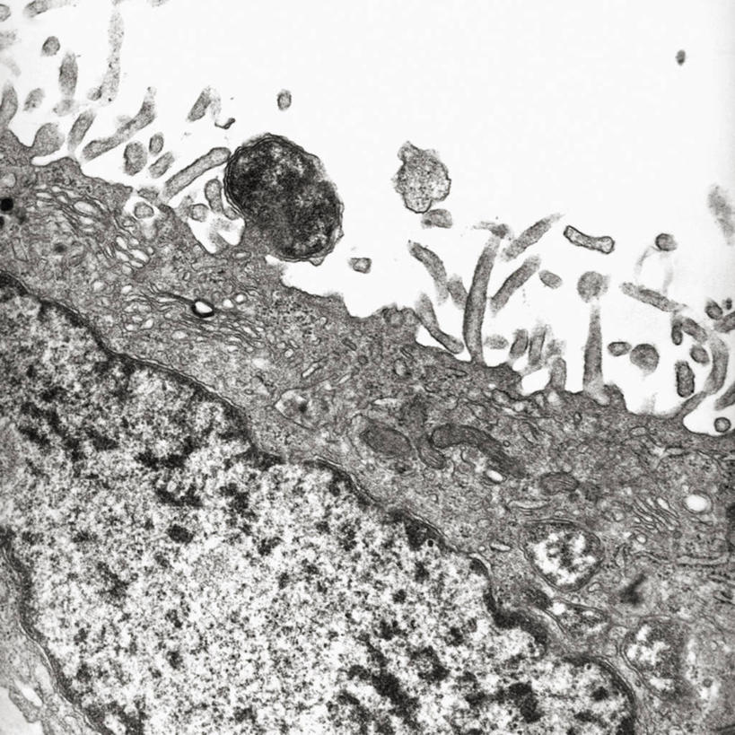 无人,方图,黑白,微生物,细胞,花蕾,生病,摄影,鼠,细胞膜,透射电子显微镜