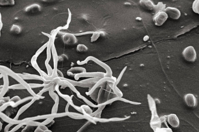 无人,横图,黑白,仪器,蜥蜴,检查,反射,分析,科学,显微镜,观察,清晰,探索,摄影,放大,观看,仔细,透镜,凸透镜,聚焦,关注,花粉,光学,清楚,扫描电镜,扫描电子显微镜,螨