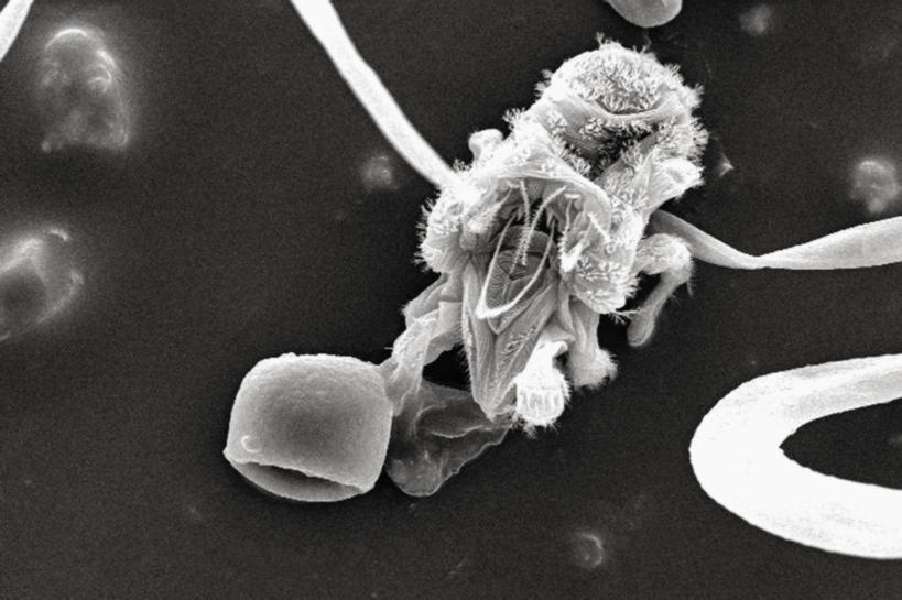 无人,横图,黑白,仪器,蜥蜴,检查,反射,分析,科学,昆虫,显微镜,观察,清晰,探索,摄影,放大,观看,仔细,透镜,凸透镜,聚焦,关注,节肢动物,光学,清楚,扫描电镜,扫描电子显微镜,螨