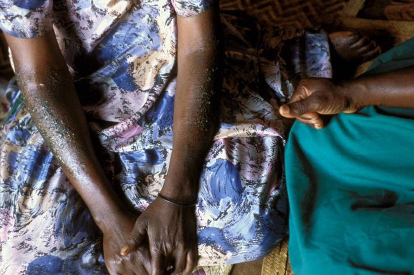 两个人,横图,室内,微生物,非洲,乌干达,医学,黑色,生病,生物,摄影,医疗,病毒,生物学,艾滋病,寄生,生命体,生物病毒,艾滋病病毒,瘟疫,中年女性,彩图,反转录病毒,逆转录病毒