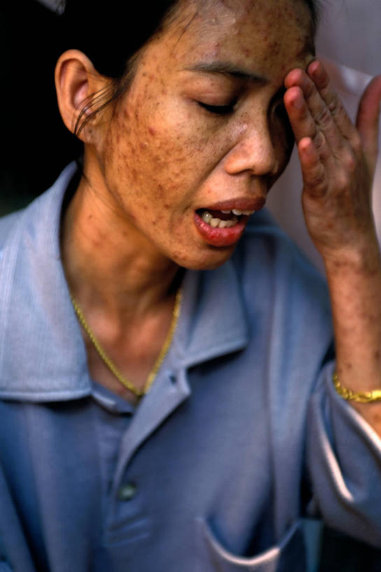 成年人,一个人,病人,竖图,微生物,泰国,仅一个女性,医学,生病,生物,摄影,佛教,医疗,病毒,生物学,脆弱,艾滋病,悲哀,寄生,生命体,生物病毒,艾滋病病毒,瘟疫,女人,彩图,反转录病毒,逆转录病毒