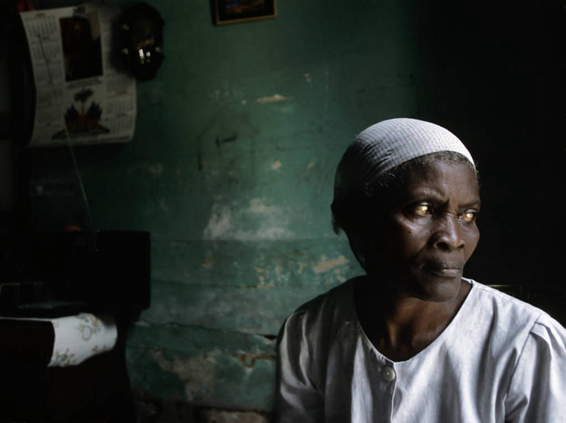 成年人,一个人,横图,海地,仅一个女性,细菌,生病,摄影,西印度群岛,肖像,淋巴系统,象皮病,伊斯帕尼奥拉岛,女人,彩图,海地人