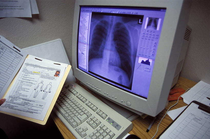 骨骼,横图,x光片,室内,显示器,键盘,技术,微生物,墨西哥,美国,辐射,科学,细菌,医学,材料,档案,文件,输入设备,通讯设备,医疗用品,资料,生病,摄影,医疗,疾病,胸腔,科学技术,x射线,北美,北美洲,加利福尼亚,文档,美洲,医疗器械,通信设备,x光,计算机设备,北亚美利加洲,亚美利加洲,结核杆菌,电脑键盘,计算机,彩图,美利坚合众国,病历卡,原核生物,电磁波,电磁辐射