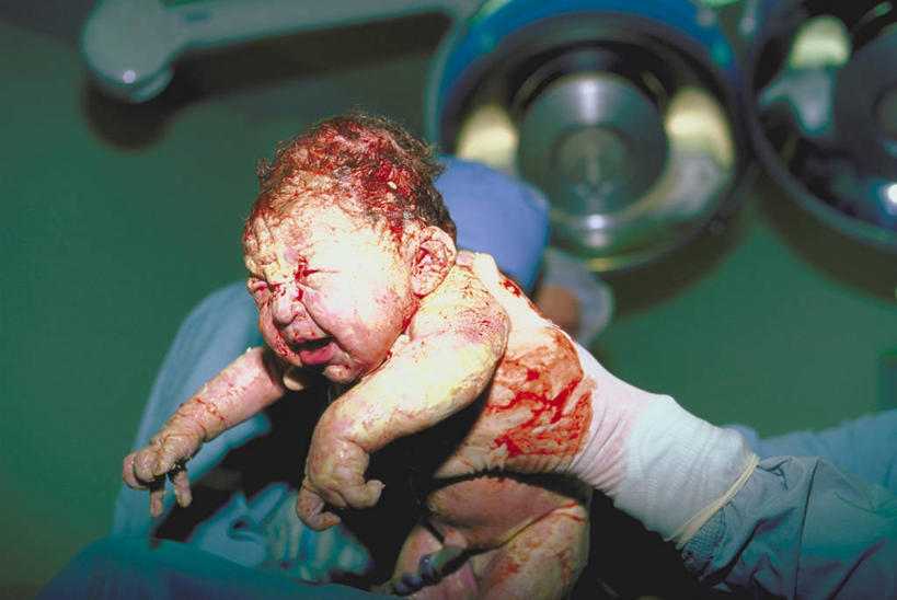 西方人,婴儿,儿童,两个人,医院,站,举,哭,横图,俯视,室内,特写,白天,纯洁,欧洲,欧洲人,握,阴影,朦胧,模糊,光线,血,工具,影子,拿,拿着,注视,小孩,阳光,观察,看,托,站着,可爱,握着,眼泪,活泼,观看,察看,分娩,泪水,关注,宝宝,纯真,烂漫,无邪,医疗机构,临盆,临蓐,伶俐,天真,年轻女性,女人,女性,白种人,孩子,举起,举手,举着,向上举,向上伸,向上托,站立,半身,彩图,高角度拍摄,哭泣,哭啼,病院,诊所