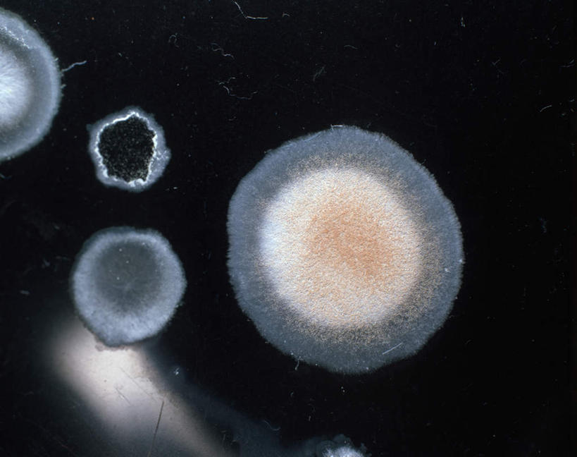 无人,横图,俯视,室内,特写,白天,桌面,桌子,微生物,阴影,黑色背景,朦胧,模糊,反射,细菌,木制,影子,木制品,生物,摄影,影棚,生命体,彩图,高角度拍摄,影棚拍摄,拍摄,原核生物