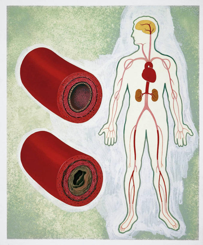 血管,无人,站,竖图,插画,数码,科技,阴影,科学,网络,标志,符号,高光,几何,计算机图形,合成,图画,标识,画,生病,人体,摄影,电脑合成图,数码合成图,合成图,漫画,写实,具体,具象,性别符号,人体结构,彩图,动脉硬化症,男性符号