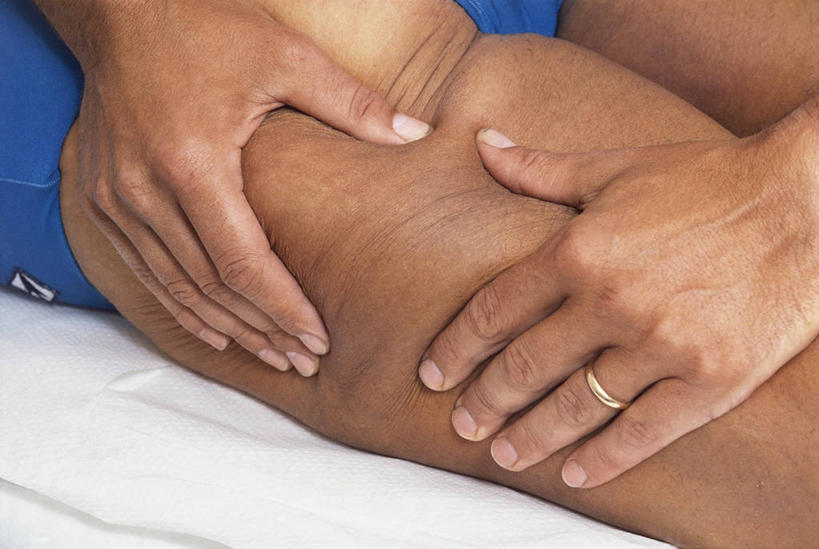 成年人,手,腿,一个人,病人,横图,室内,特写,白天,化妆,美容,仅一个女性,护肤,挤,拿着,保养,享受,休闲,放松,保健,人体,摄影,皮肤,部分,养颜,彩图,SPA美容,蜂窝织炎