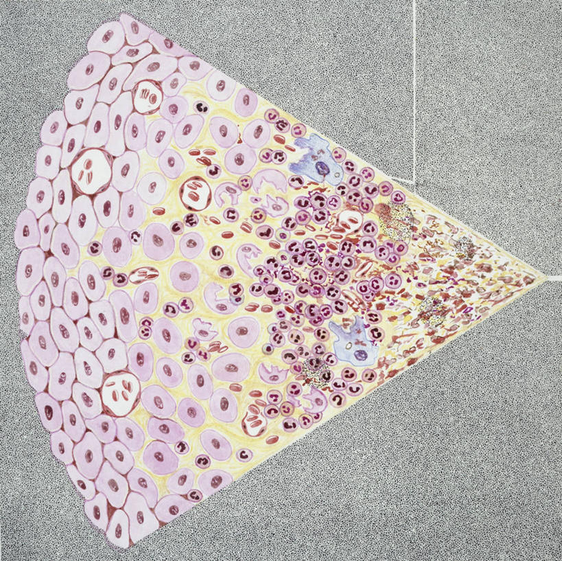 无人,横图,方图,插画,特写,数码,科技,阴影,网络,高光,几何,计算机图形,合成,图画,画,生病,摄影,电脑合成图,数码合成图,疾病,合成图,漫画,写实,具体,具象,彩图,脓肿