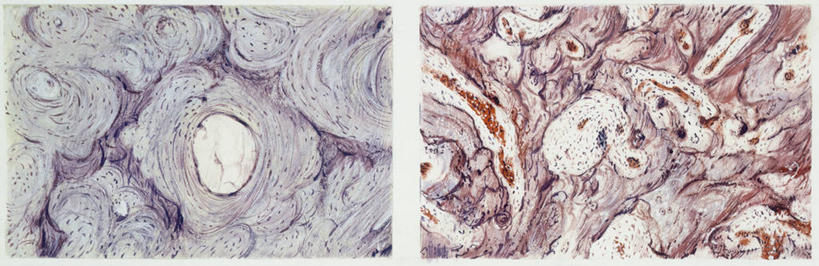 骨骼,无人,横图,全景,插画,数码,科技,阴影,网络,高光,几何,计算机图形,合成,图画,画,生病,人体,摄影,电脑合成图,数码合成图,手术,疾病,合成图,反差,漫画,整形,写实,具体,具象,畸形,彩图,外科手术,医疗美容外科手术,整形手术