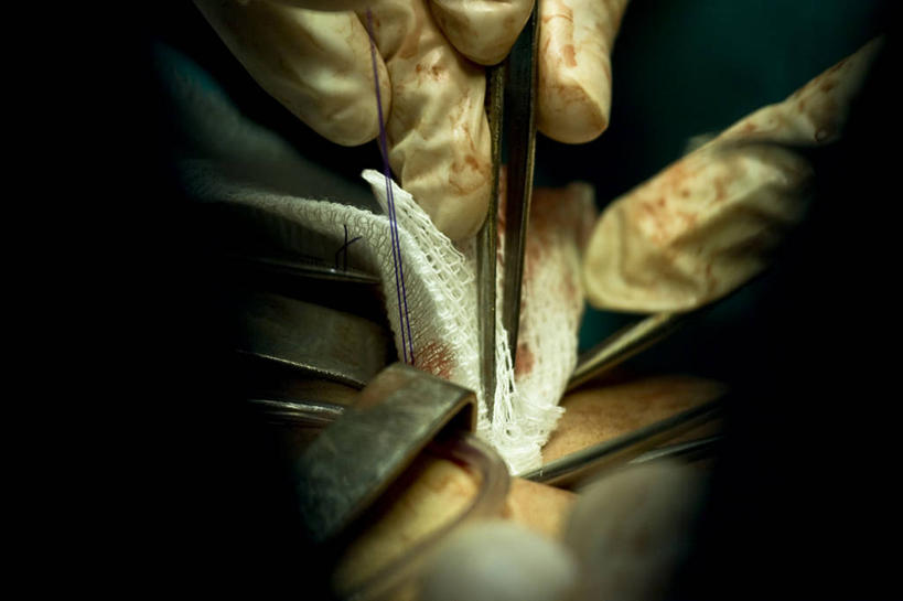 手,两个人,横图,室内,特写,风险,安全,阿根廷,镊子,防护,拿着,针,手套,手指,血液,人体,摄影,保护,部分,手术,手术室,专心,准确,保险,保全,周全,安稳,安定,防护手套,技能,平安,绷带,彩图,缝合针,医用缝合针