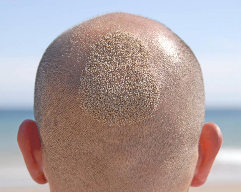 成年人,头,秃头,一个人,横图,室外,特写,白天,海洋,英国,仅一个男性,沙子,背面,天空,人体,摄影,头像,幽默,想法,头部,光头,无发,彩图