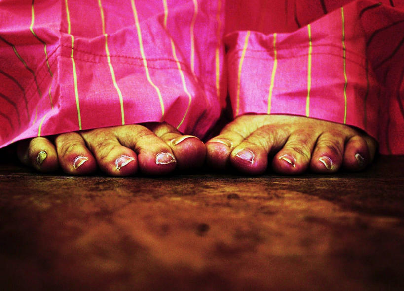 腿部,脚,脚趾,脚趾甲,腿,一个人,横图,室内,特写,正面,美国,条纹,朦胧,模糊,粉色,赤脚,人体,摄影,肮脏,足,丑陋,邋遢,龌龊,污秽,摇滚乐,脚指甲