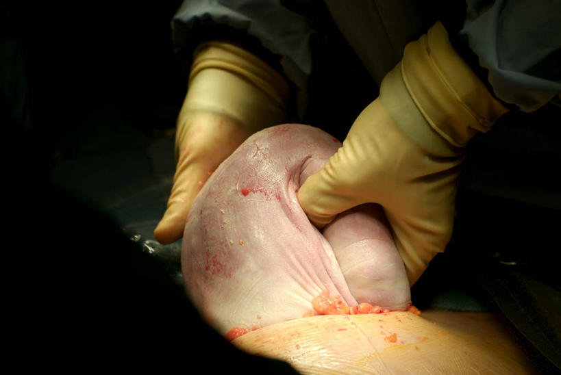 婴儿,儿童,手,胃,一个人,三个人,拉,横图,室内,纯洁,安全,美国,仅一个人,防护,拿着,小孩,手套,可爱,人体,摄影,活泼,保护,部分,手术,分娩,关爱,宝宝,保险,纯真,烂漫,无邪,保全,周全,安稳,安定,防护手套,消化道,吸收,消化管,康科德,消化,排泄,开端,摄取,伶俐,平安,天真,孩子,消化腺,转运,消化系统