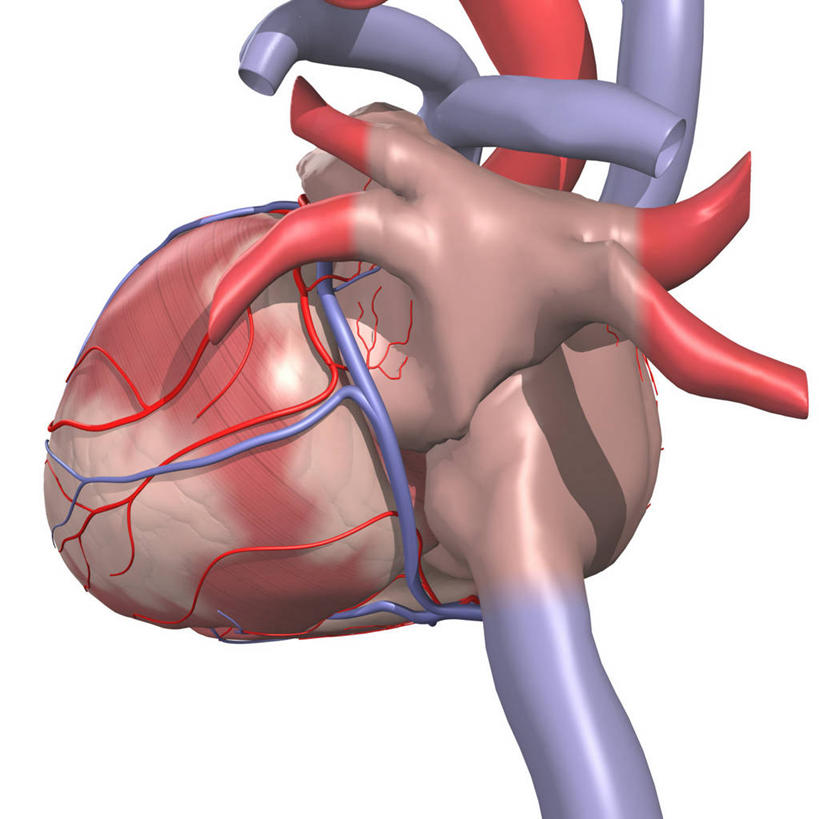 心脏,血管,无人,方图,插画,白色背景,数码,科技,阴影,网络,高光,几何,计算机图形,合成,图画,画,电脑合成图,数码合成图,疾病,合成图,漫画,心房,心室,写实,具体,具象,下腔静脉,冠状动脉,心血管病,心血管疾病,心脏病,循环系统疾病,人体结构,心,彩图,心肌梗塞,心脏搭桥手术