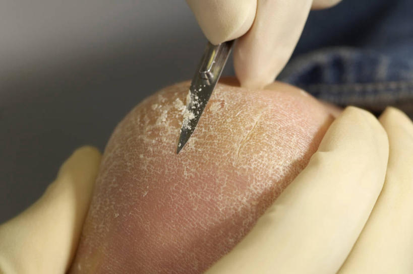 两个人,医生,病人,医院,横图,室内,特写,安全,防护,英格兰,手套,手指,抓,摄影,皮肤,保护,部分,脚掌,解剖刀,保险,干的,足,保全,周全,安稳,安定,防护手套,平安,彩图,门诊部,修脚