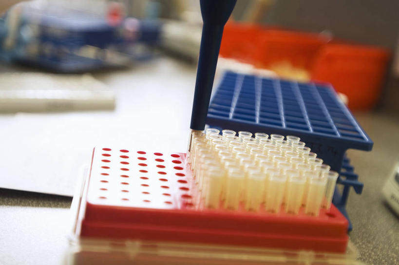 无人,横图,室内,研究,科学,试管架,实验室,英格兰,摄影,准确,吸液管,肾上腺,唾液,彩图