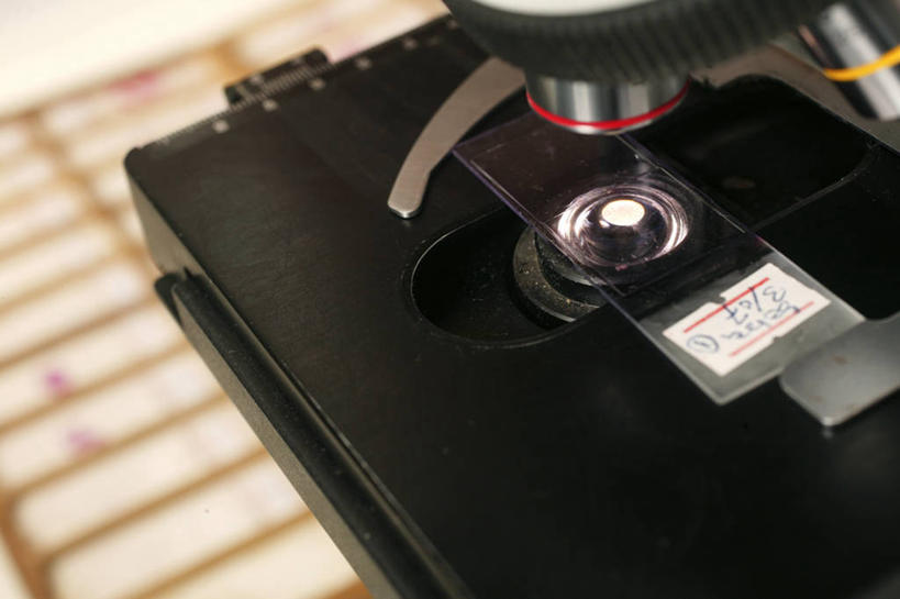 无人,医院,横图,俯视,室内,特写,技术,苏丹,研究,分析,数字,显微镜,一个,血液,摄影,单个,部分,透镜,血细胞,医疗器械,医疗工具,载玻片,癌症,玻片,盖玻片,彩图,高角度拍摄