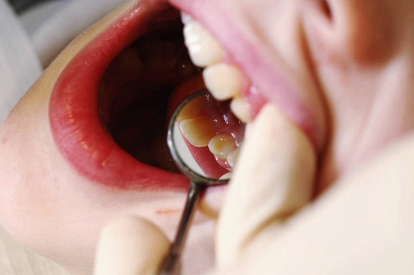 儿童,成年人,嘴,手,牙齿,两个人,横图,室内,特写,工作服,制服,安全,检查,防护,拿着,英格兰,两个,手套,张嘴,摄影,保护,部分,手术,牙科设备,保险,防护服,张大嘴巴,保全,周全,安稳,安定,防护手套,工作制服,平安,男孩,年轻男性,年轻人,齿,口,口腔,牙,牙龈,嘴巴,嘴唇,牙医,张开嘴,彩图,工作套服,折角镜