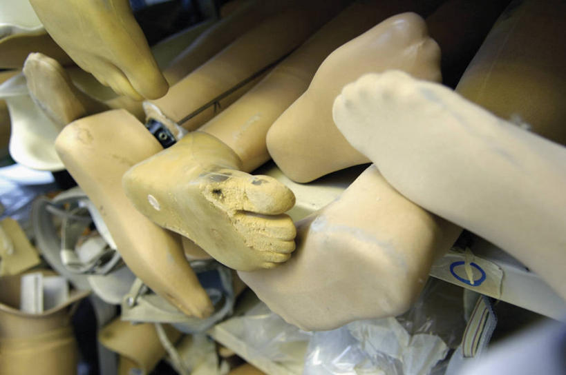 腿,无人,横图,室内,白天,许多,塑胶,很多,英格兰,架子,摄影,多样,手术,脚掌,残疾,假肢,整形,四肢,彩图,外科手术,医疗美容外科手术,整形手术