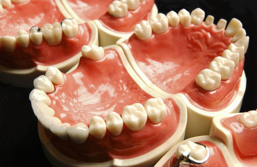 牙齿,无人,横图,黑色背景,三个,打开,摄影,开启,假牙,假肢,颌骨,丙稀画,齿,牙,牙龈,彩图,影棚拍摄