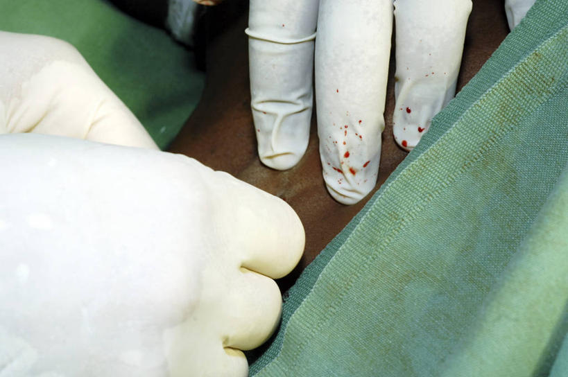 血管,三个人,横图,俯视,室内,特写,化妆,安全,苏丹,防护,手套,血液,摄影,保护,部分,手术,手术室,金属丝,保险,外科医生,保全,周全,安稳,安定,防护手套,颈内静脉,导尿管,平安,彩图,高角度拍摄,颈外静脉