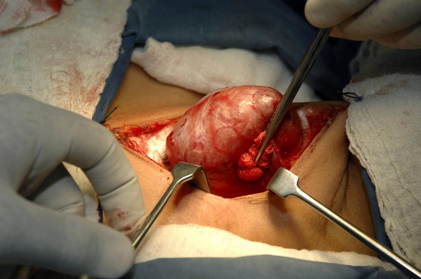 手,两个人,医院,横图,室内,特写,白天,安全,苏丹,镊子,防护,手套,纸巾,血液,摄影,保护,协助,部分,手术,伤口,手术室,准确,保险,外科医生,保全,周全,安稳,安定,防护手套,甲状腺,技能,平安,彩图