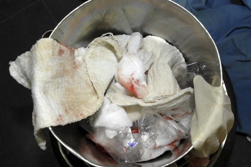 无人,医院,横图,俯视,室内,特写,白天,安全,苏丹,许多,防护,垃圾,垃圾桶,很多,凌乱,手套,纸巾,摄影,保护,有毒废物,手术,疾病,手术室,保险,眩晕,保全,周全,安稳,安定,防护手套,心血管疾病,平安,彩图,高角度拍摄,房颤,心房颤动,心悸,心律失常