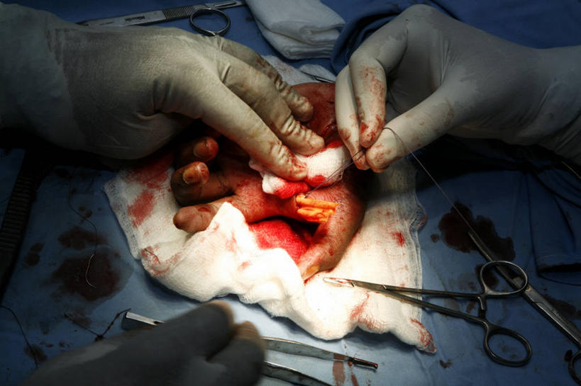 成年人,手,三个人,推,横图,室内,特写,安全,纱布,防护,骨头,拿着,手套,血液,摄影,保护,部分,手术,伤口,手术室,拼接,解剖刀,保险,切断,手术台,医疗工具,外科医生,保全,周全,安稳,安定,缝合,防护手套,平安,男人,彩图,神经系统,缝线