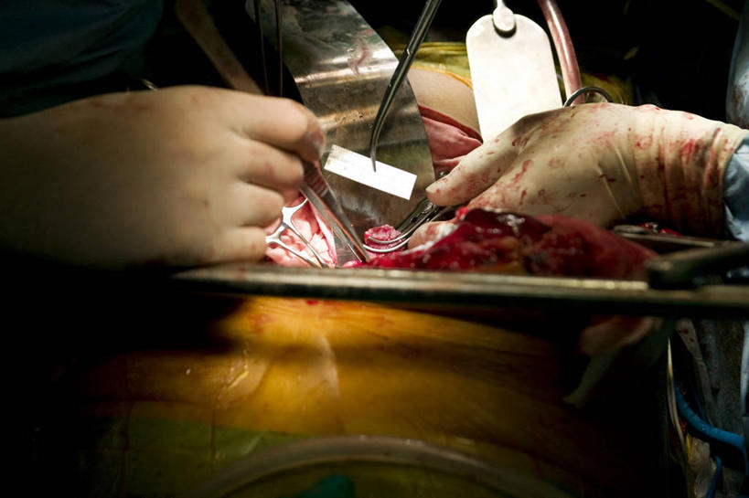 成年人,手,三个人,横图,室内,特写,安全,合作,团队,首尔,韩国,不锈钢,防护,首都,拿着,手套,职业,血液,治疗,摄影,保护,协助,部分,手术,医疗,准确,开刀,保险,医疗工具,外科医生,保全,周全,安稳,安定,防护手套,消化道,吸收,消化管,消化,排泄,手术器械,摄取,平安,彩图,外科手术,消化腺,转运,消化系统