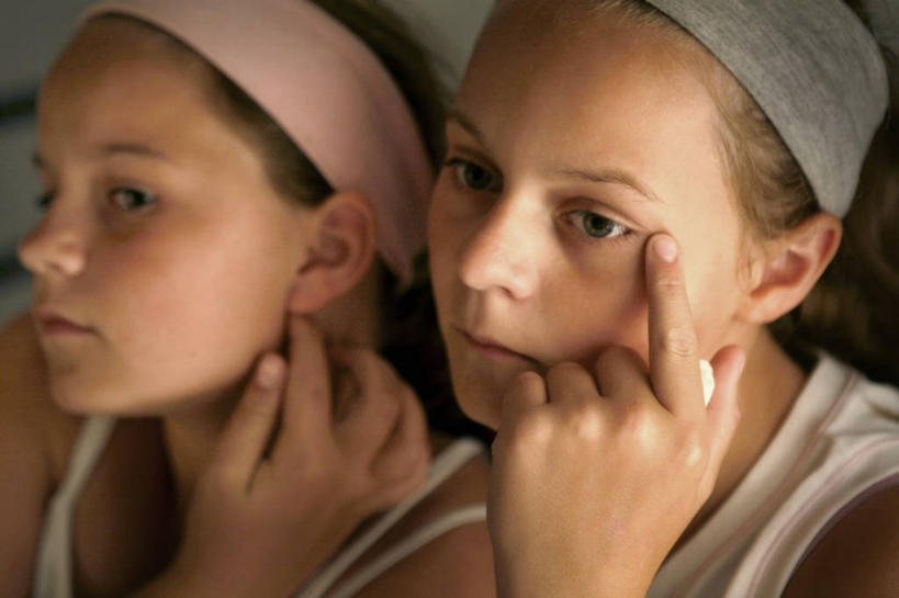 儿童,脸,头,脸颊,一个人,两个人,横图,室内,特写,白天,纯洁,仅一个女性,仅一个人,束发带,英格兰,肩膀,小孩,仅一个小孩,可爱,童年,童趣,摄影,皮肤,疾病,卫生,青春期,童真,皮肤病,烂漫,无邪,美化,天真,女孩,女人,女性,孩子,头部,脸部,脸蛋,面部,触摸,彩图,女生