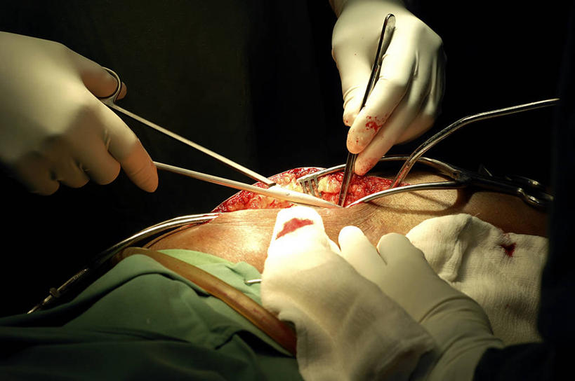 手,骨骼,三个人,横图,室内,安全,苏丹,纱布,防护,手套,血液,人体,摄影,臀,保护,部分,手术,保险,整形,保全,周全,安稳,安定,防护手套,手术剪刀,骨质疏松症,手术器械,平安,彩图,外科手术,医疗美容外科手术,整形手术,人工髋关节