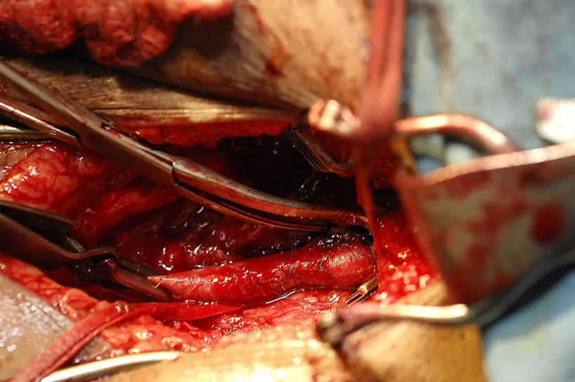 手,一个人,医院,横图,室内,特写,白天,苏丹,镊子,纸巾,血液,摄影,肮脏,协助,部分,手术,伤口,手术室,准确,外科医生,邋遢,龌龊,污秽,技能,彩图