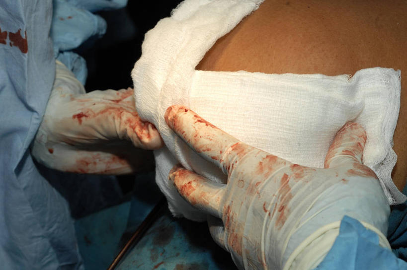 腿,两个人,横图,室内,特写,工作服,制服,安全,纱布,防护,手套,血液,摄影,保护,部分,手术,伤口,手术室,保险,外科医生,结束,保全,周全,安稳,安定,防护手套,工作制服,四肢,平安,彩图,工作套服,手术衣