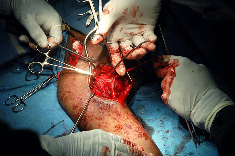 肩,动脉,关节,血管,三个人,横图,室内,特写,工作服,制服,安全,团队,苏丹,防护,拿着,手套,血液,摄影,皮肤,保护,部分,手术,准确,保险,医疗工具,外科医生,保全,周全,安稳,安定,防护手套,手术剪刀,工作制服,四肢,平安,手臂,彩图,工作套服