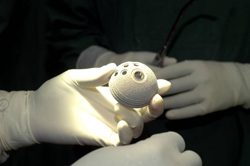 手,两个人,横图,室内,特写,安全,苏丹,金属,防护,拿着,手套,摄影,保护,部分,手术,保险,假肢,整形,保全,周全,安稳,安定,防护手套,骨质疏松症,平安,彩图,外科手术,医疗美容外科手术,整形手术,骨关节炎,人工髋关节