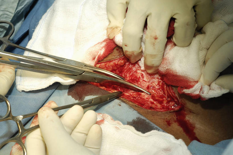 成年人,三个人,横图,俯视,室内,安全,苏丹,纱布,防护,手套,怀孕,血液,摄影,皮肤,保护,部分,手术,分娩,解剖刀,保险,切断,保全,周全,安稳,安定,防护手套,手术剪刀,剖腹产,平安,女人,彩图,高角度拍摄