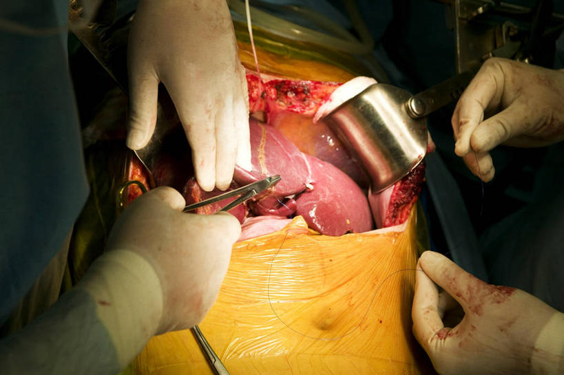 成年人,手,三个人,横图,室内,特写,安全,合作,团队,首尔,韩国,不锈钢,防护,首都,拿着,手套,职业,血液,治疗,摄影,保护,协助,部分,手术,医疗,准确,开刀,保险,切断,医疗工具,外科医生,保全,周全,安稳,安定,防护手套,消化道,吸收,消化管,消化,排泄,手术器械,摄取,平安,彩图,外科手术,消化腺,转运,消化系统