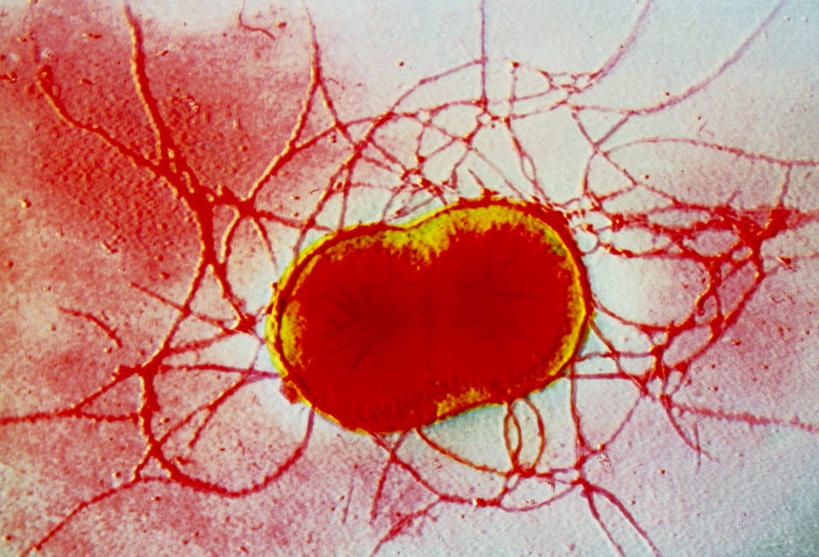 无人,横图,俯视,室内,特写,白天,仪器,微生物,检查,反射,分析,科学,细菌,显微镜,线条,红色,观察,生物,清晰,探索,放大,观看,仔细,透镜,凸透镜,聚焦,关注,光学,清楚,杆菌,生命体,显微图片,彩图,高角度拍摄,透射电子显微镜,原核生物,变形杆菌,奇异变形杆菌