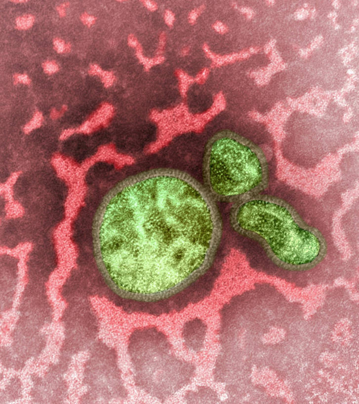 无人,竖图,俯视,室内,特写,白天,仪器,微生物,检查,反射,分析,科学,医学,显微镜,红色,绿色,观察,生物,清晰,探索,放大,观看,仔细,透镜,医疗,病毒,疾病,生物学,凸透镜,聚焦,关注,流感,光学,清楚,传染病,寄生,甲型流感病毒,生命体,生物病毒,流感病毒,显微图片,彩图,高角度拍摄,透射电子显微镜,甲型H1N1流感,急性呼吸道传染病,甲型H1N1