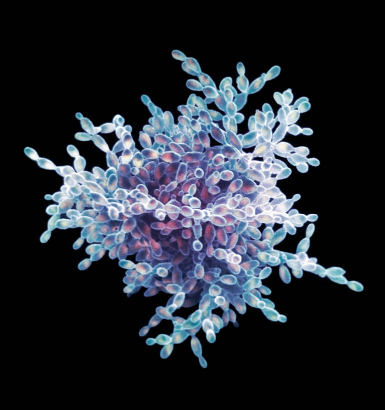 无人,竖图,俯视,室内,特写,白天,仪器,微生物,黑色背景,检查,反射,分析,科学,医学,细胞,显微镜,蓝色,观察,清晰,探索,放大,观看,仔细,透镜,生物学,凸透镜,聚焦,真菌,关注,光学,清楚,酵母,酵母菌,显微图片,彩图,高角度拍摄,食品添加剂,添加剂,扫描电镜,扫描电子显微镜