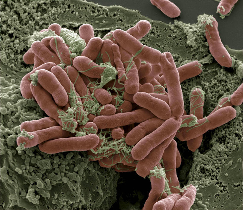 无人,横图,俯视,室内,特写,白天,仪器,微生物,检查,反射,分析,科学,细菌,显微镜,绿色,观察,橙色,生物,清晰,探索,放大,观看,仔细,透镜,凸透镜,聚焦,关注,光学,清楚,生命体,大肠杆菌,肠杆菌,大肠埃希氏菌,显微图片,彩图,高角度拍摄,扫描电镜,扫描电子显微镜,原核生物