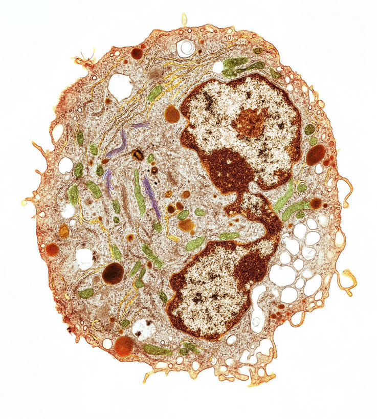 无人,竖图,俯视,室内,特写,白天,白色背景,仪器,微生物,检查,反射,分析,科学,医学,细胞,显微镜,观察,清晰,探索,放大,观看,仔细,透镜,生物学,凸透镜,聚焦,关注,横截面,剖面,白细胞,光学,清楚,白血球,显微图片,截面,截面图形,彩图,高角度拍摄,免疫细胞,透射电子显微镜,白血细胞